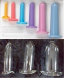 Pure Romance and Pacik Glass Dilators used in the Botox treatment of Vaginismus